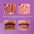 QV Dermcare Sting-Free Ointment